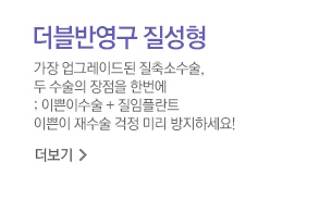 더블반영구질성형