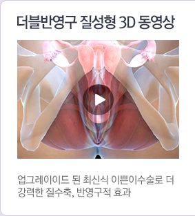 더블반영구질성형3d동영상